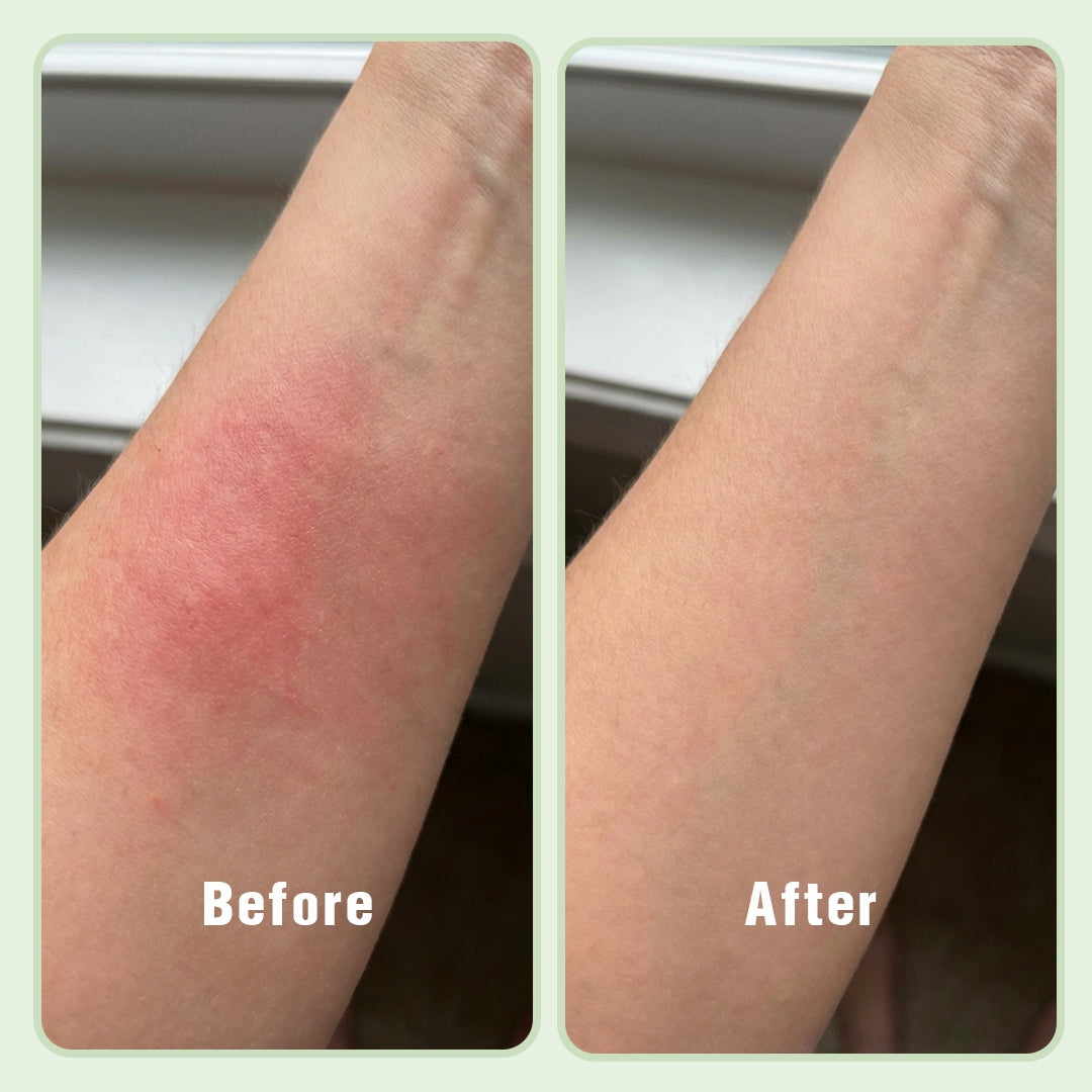 Panax Polysaccharide Repairing Lotion